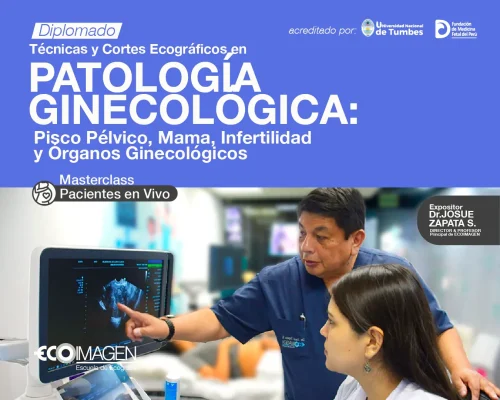 Diplomado | Técnicas y Cortes Ecográficos en Patología Ginecología: Piso Pélvico, Mama, Infertilidad y Órganos Ginecológicos | 2024