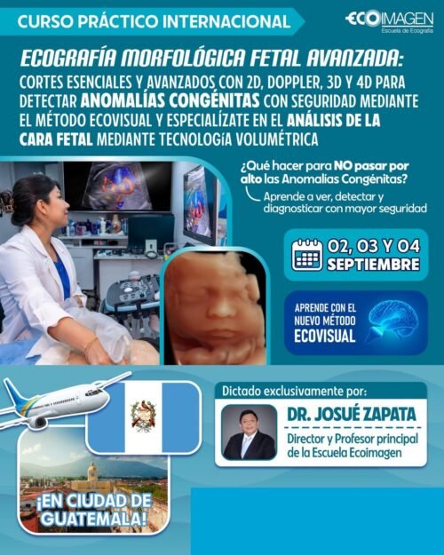 CURSO INTERNACIONAL DE ECOGRAFÍA MORFOLÓGICA FETAL AVANZADA: Cortes Esenciales y Avanzados con 2D, Doppler, 3D y 4D para Detectar Anomalías Congénitas con Seguridad mediante el Método EcoVisual y especialízate en el análisis de la cara Fetal mediante tecnología Volumétrica en Guatemala 🇬🇹